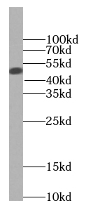 anti- BCS1L antibody