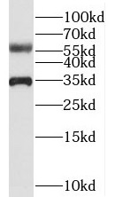      anti- BEND4 antibody