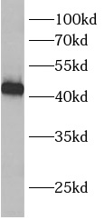      anti- BCKDHB antibody