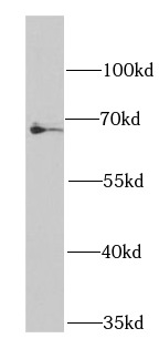      anti- BCHE antibody