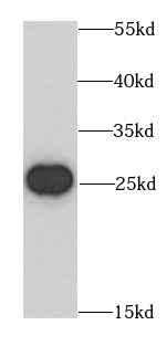 anti- BCAS2 antibody