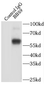      anti- BBS9 antibody