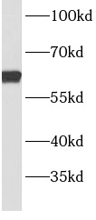      anti- BBS9 antibody