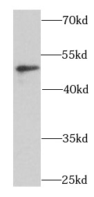      anti- BCCIP antibody