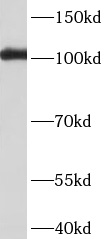      anti- BBX antibody