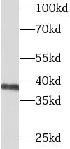      anti- BCAT2 antibody