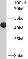      anti- BCL7B antibody