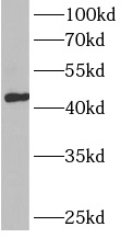      anti- BCAT1/ECA39 antibody