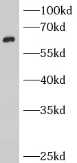      anti- BCMO1 antibody