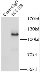 BCL11B抗体