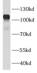 anti- BCL11B antibody