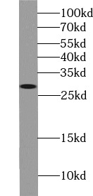      anti- BCL2 antibody