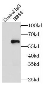 BBS8抗体