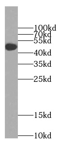 anti- BBS8 antibody