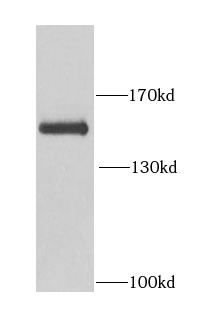      anti- BCR antibody