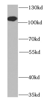      anti- BCAS3 antibody