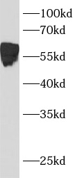      anti- BCL3 antibody