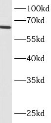      anti- BCO2 antibody