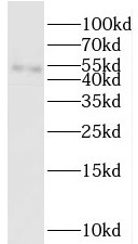      anti- C14orf39 antibody