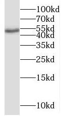      anti- BRUNOL6 antibody