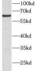 anti- BMPR1A antibody