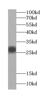      anti- C14orf94 antibody