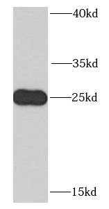      anti- C14orf166 antibody