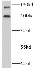 anti- BMPR2 antibody