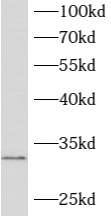 anti- ATPAF2 antibody