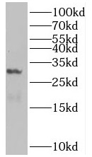      anti- BHLHA15 antibody