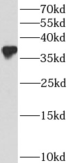      anti- BCL2L14 antibody