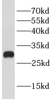      anti- BCL2L12 antibody