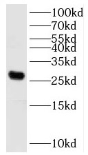      anti- C15orf29 antibody