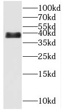      anti- C14orf28 antibody