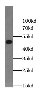      anti- BRUNOL5 antibody