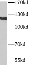      anti- ATP8A1 antibody