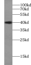 anti- Aurora B antibody