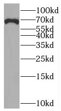 anti- BRCC3 antibody