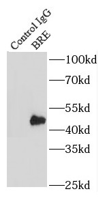 BRE抗体