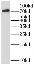      anti- BRD7 antibody