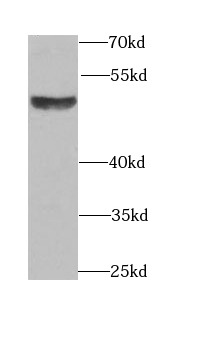 anti- BMP15 antibody