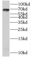      anti- BLNK antibody