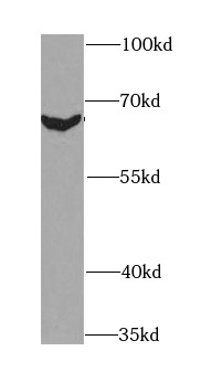 anti- BIN1 antibody