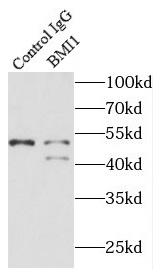      anti- BMI1 antibody