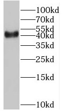      anti- BMI1 antibody