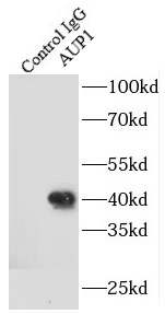      anti- AUP1 antibody