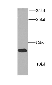      anti-ATPIF1 antibody