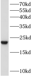 anti- BAALC antibody