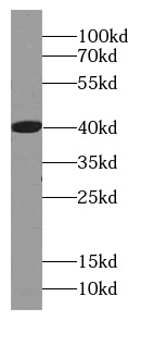      anti- AZGP1 antibody