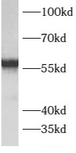      anti- ATPB antibody